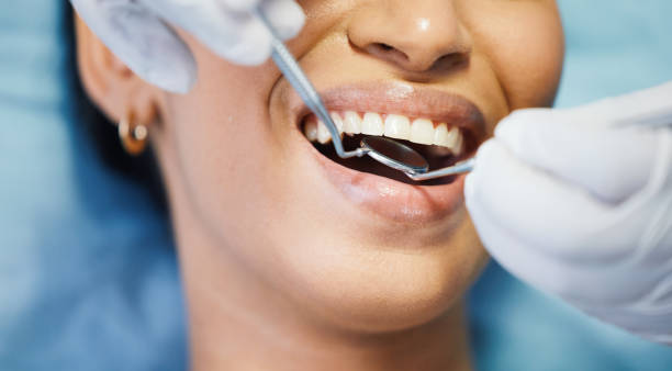 Best Emergency Dental Care for Broken or Chipped Teeth in Pantops, VA