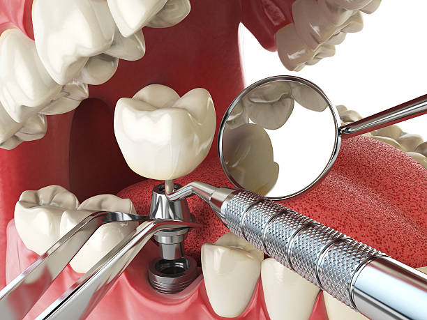 Best Emergency Gum Treatment in Pantops, VA
